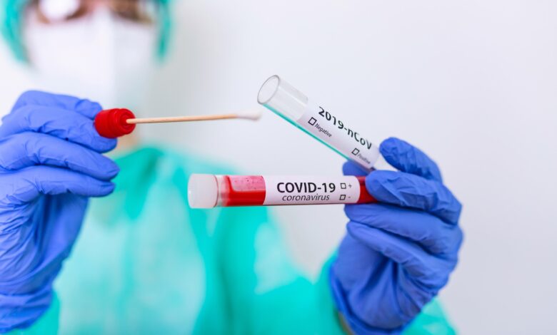 covid-eboli-dipendente-comunale-positivo-22-febbraio