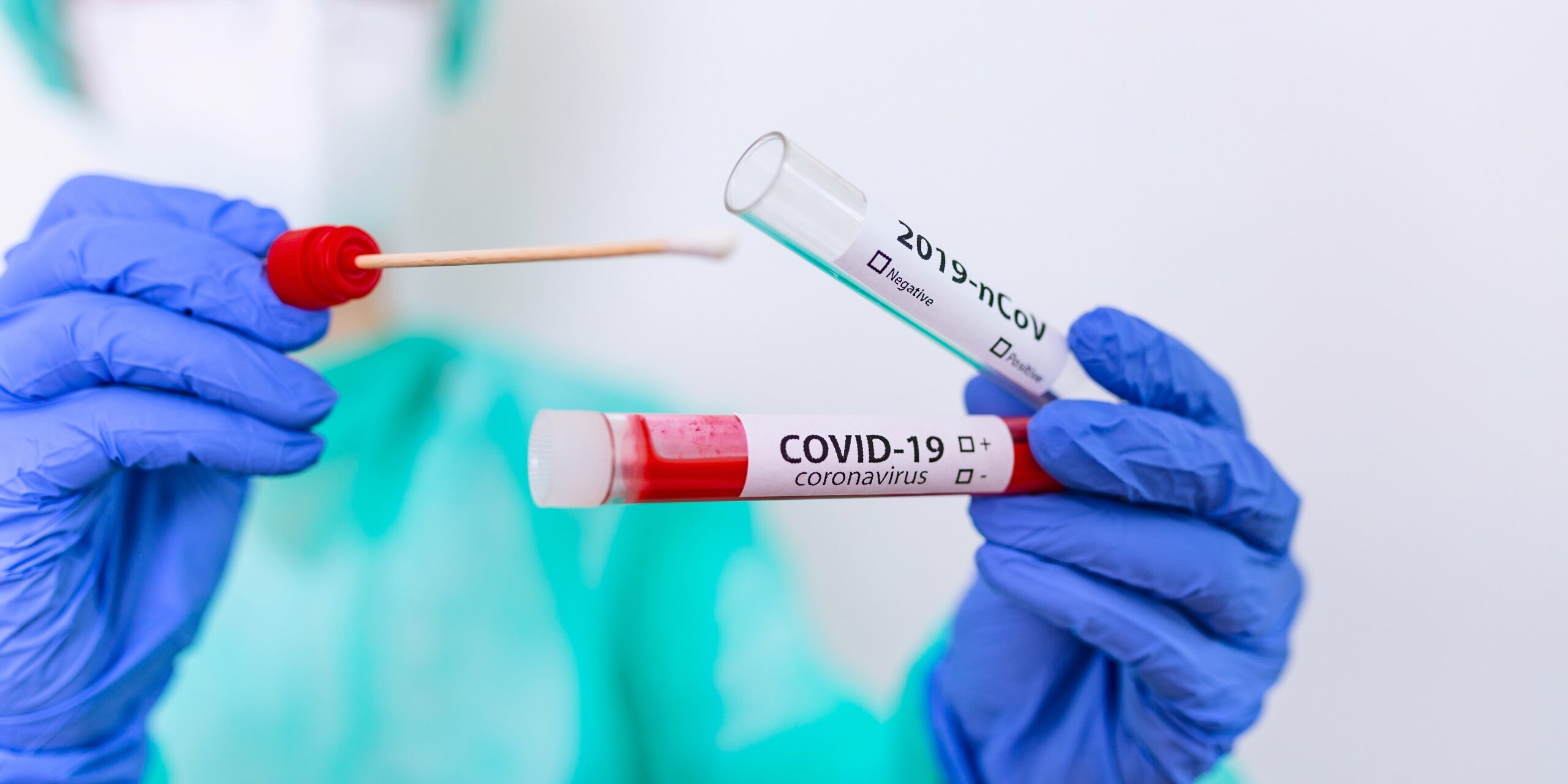 covid-eboli-casi-positivi-aggiornamento-10-gennaio